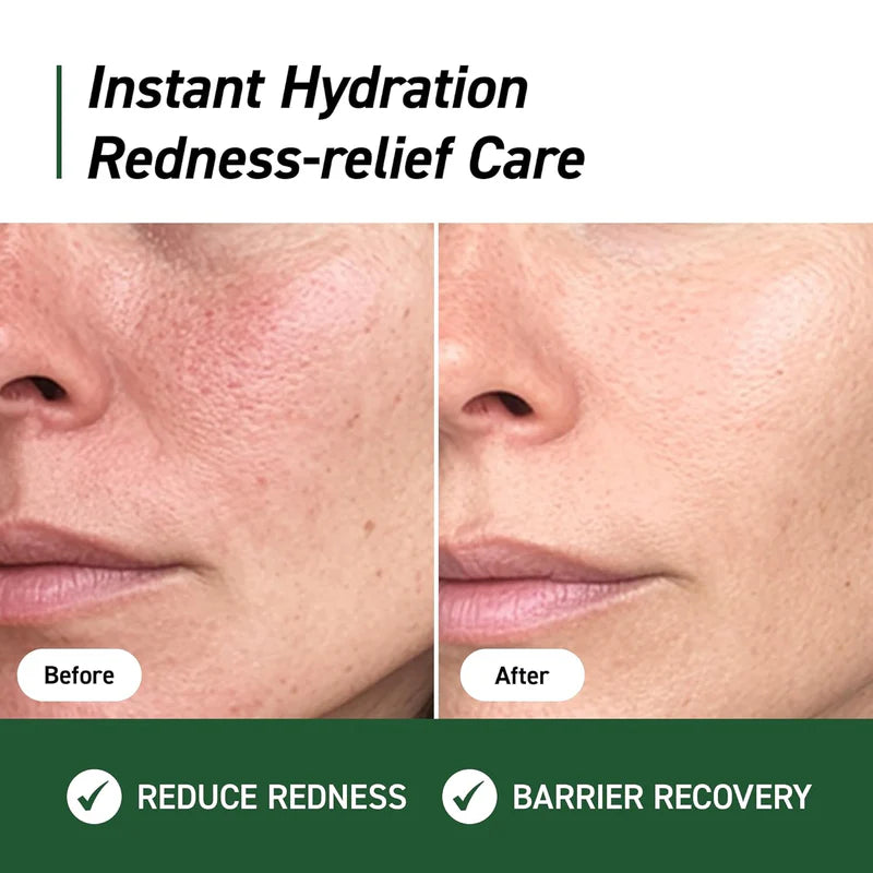 Ivoskin Cica Repair Cream